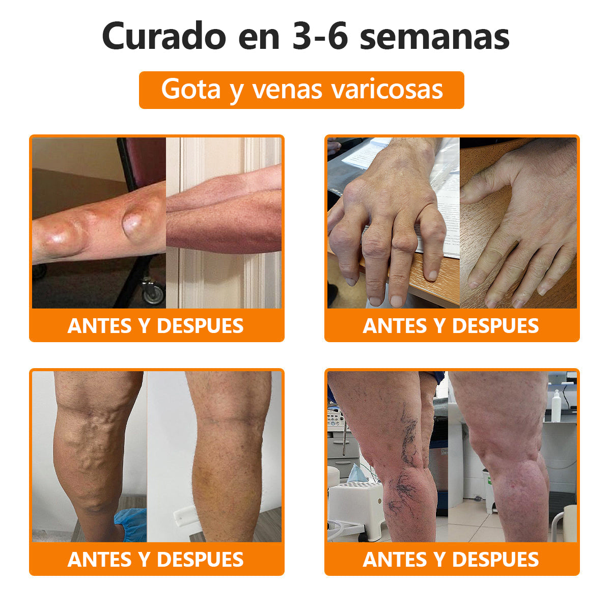 Lenaro™ Bee Venom & Turmeric Crema para el Alivio del Dolor en las Articulaciones y los Huesos (se especializa en el dolor de las articulaciones y la artritis y AAOS recomienda)