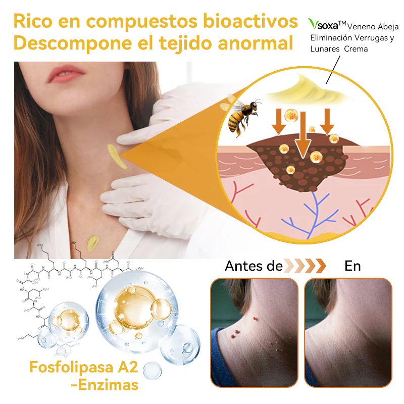 Lenaro™🏆🏆🏆 Veneno Abeja Eliminación Verrugas y Lunares Crema (🌞Último día de promoción 80% de descuento)