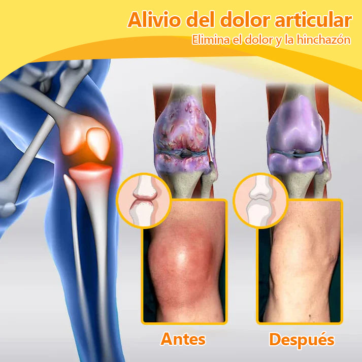 Lenaro™ Bee Venom & Turmeric Crema para el Alivio del Dolor en las Articulaciones y los Huesos (se especializa en el dolor de las articulaciones y la artritis y AAOS recomienda)