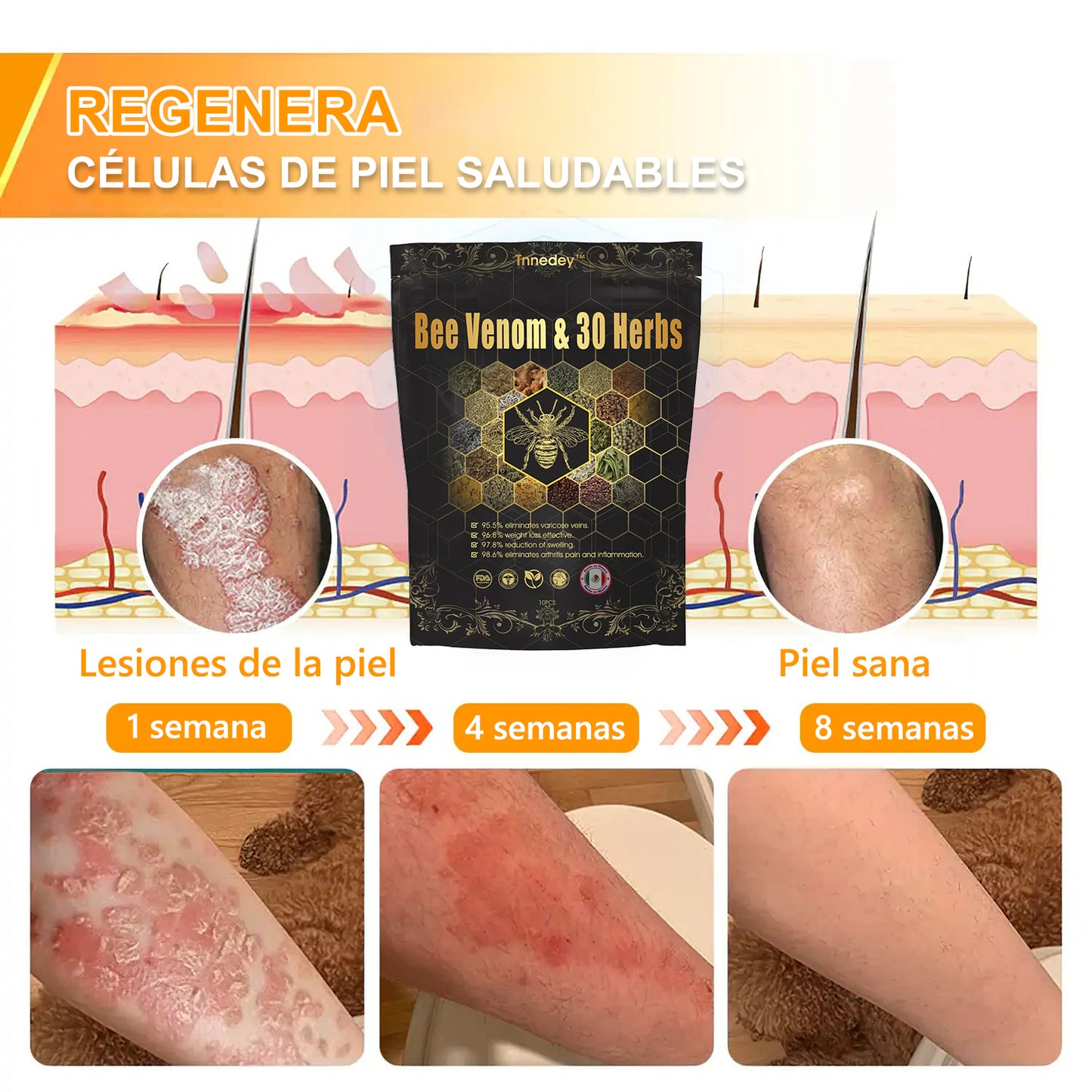 Último día con 70 % de descuento: Tnnedey® veneno de abeja y 30 perlas de baño de pies desintoxicantes a base de hierbas para esculpir el cuerpo - Recomendado por la Academia Linfática Mexicana (AML) 🌿