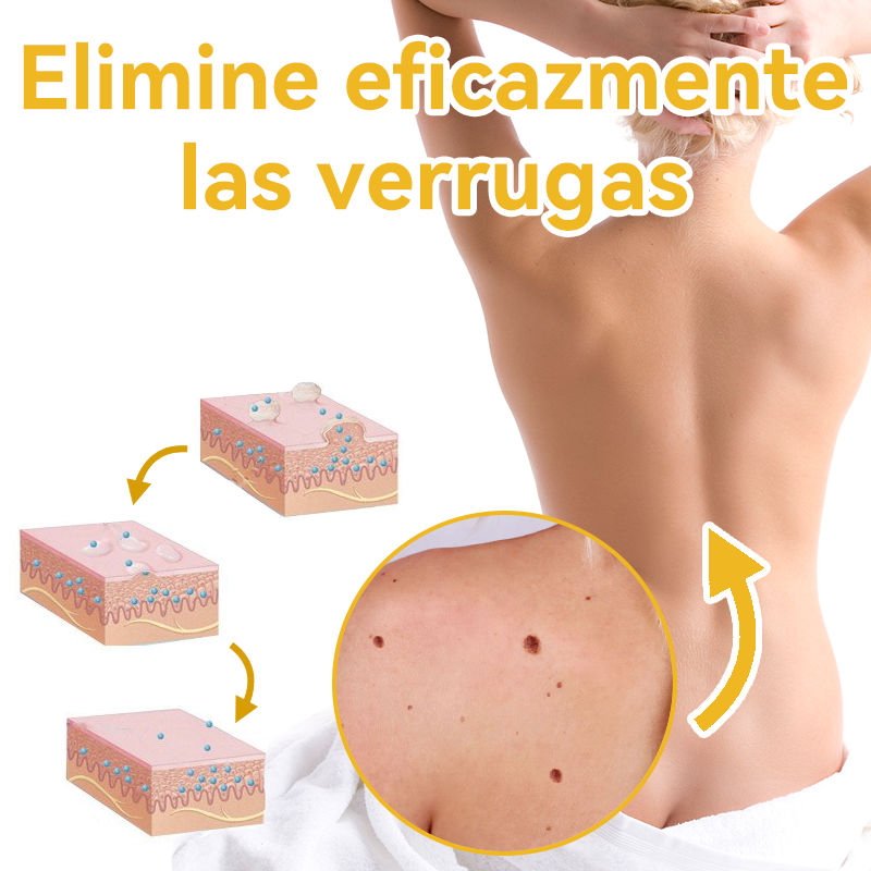 Lenaro™🏆🏆🏆 Veneno Abeja Eliminación Verrugas y Lunares Crema (🌞Último día de promoción 80% de descuento)