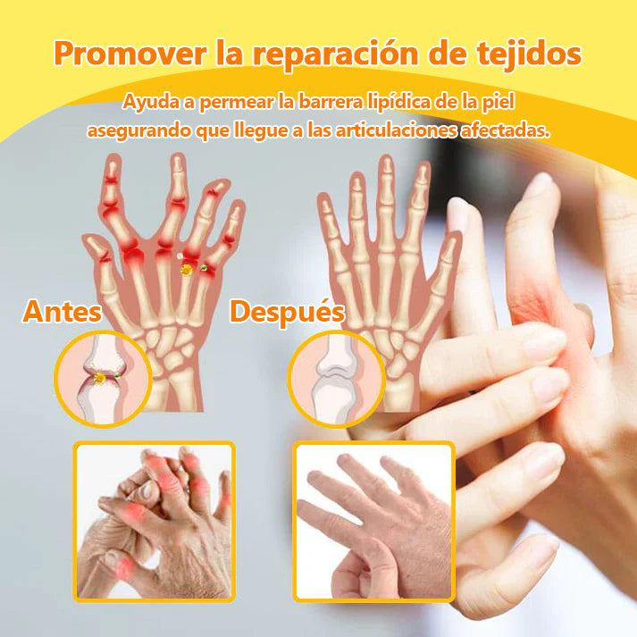 Lenaro™ Bee Venom & Turmeric Crema para el Alivio del Dolor en las Articulaciones y los Huesos (se especializa en el dolor de las articulaciones y la artritis y AAOS recomienda)