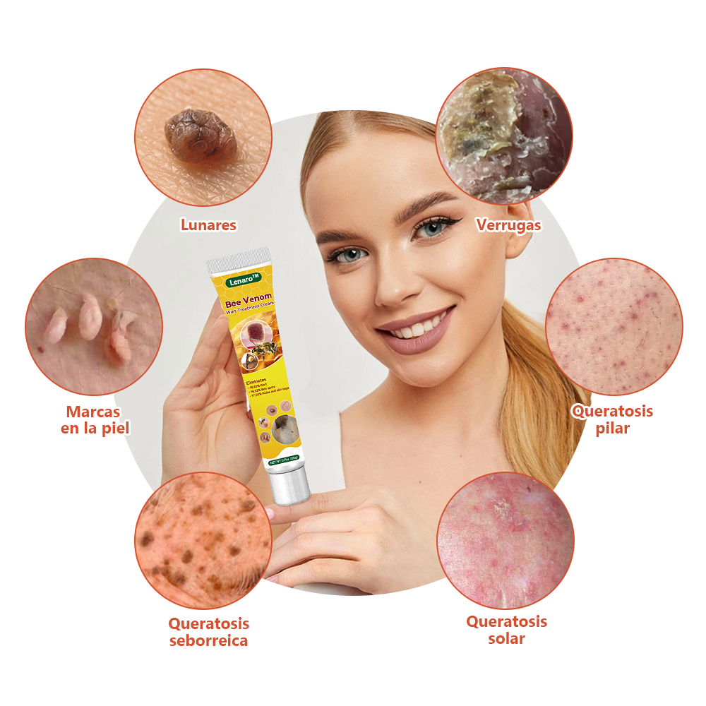 Lenaro™ Crema para el tratamiento de verrugas con veneno de abeja💎 (👨⚕️COFEPRIS RECOMMENDS)