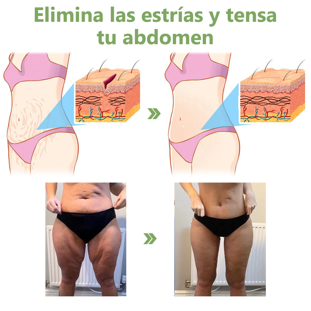 Último día de descuento: 70% de descuento💥LEFUN®Aceite rejuvenecedor reafirmante de la piel