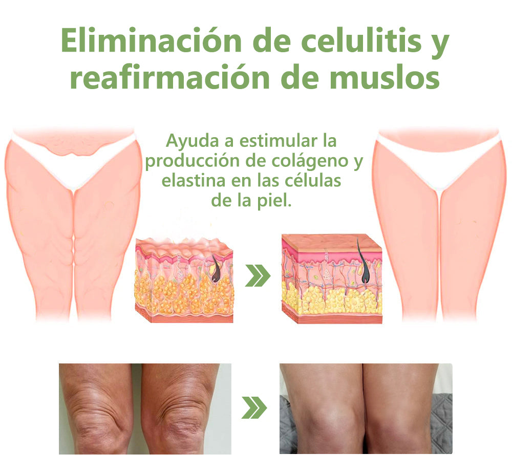 Último día de descuento: 70% de descuento💥LEFUN®Aceite rejuvenecedor reafirmante de la piel