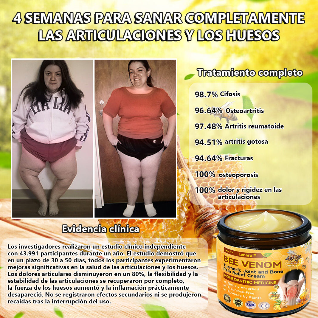 Lenaro™ Bee Venom & Turmeric Crema para el Alivio del Dolor en las Articulaciones y los Huesos (se especializa en el dolor de las articulaciones y la artritis y AAOS recomienda)