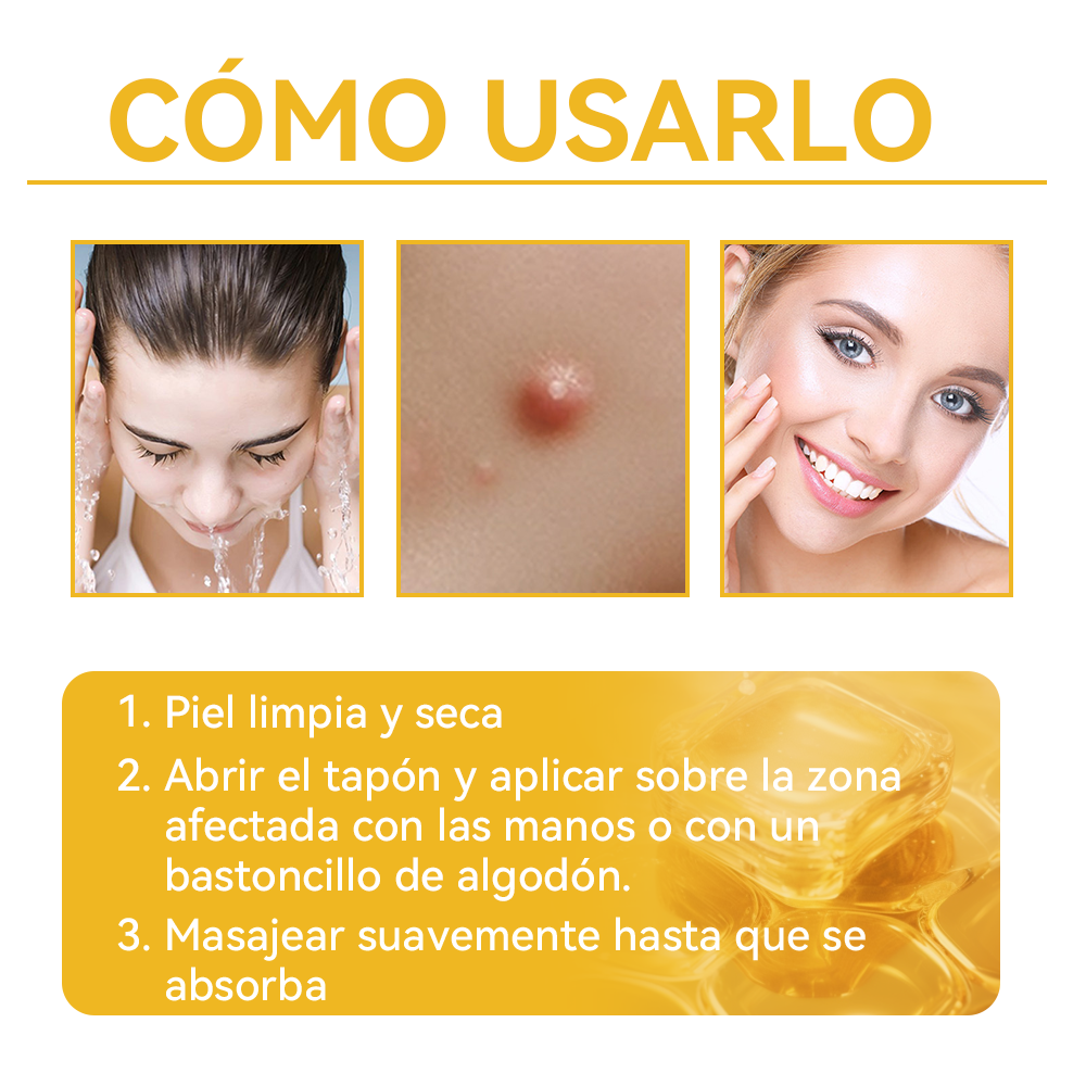 Lenaro™🏆🏆🏆 Veneno Abeja Eliminación Verrugas y Lunares Crema (🌞Último día de promoción 80% de descuento)