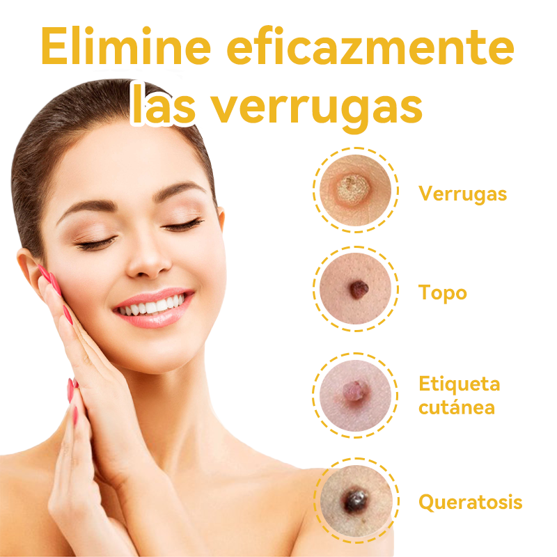 Lenaro™🏆🏆🏆 Veneno Abeja Eliminación Verrugas y Lunares Crema (🌞Último día de promoción 80% de descuento)