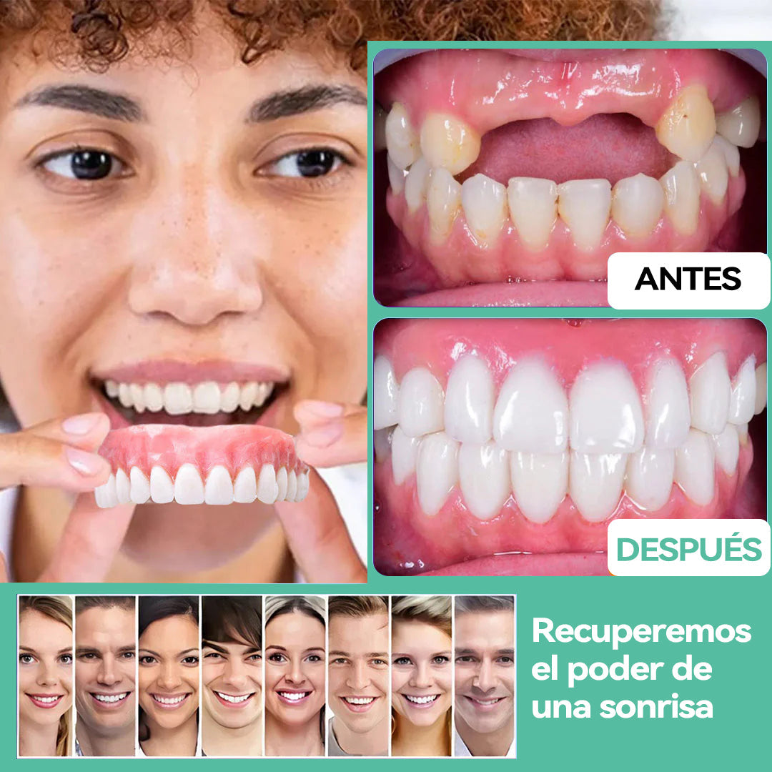 Bikenda™🔥Silicona Juego de prótesis Reline(🔥¡Oferta exclusiva! El precio más bajo por caja es de solo 140$ MXN)🎁