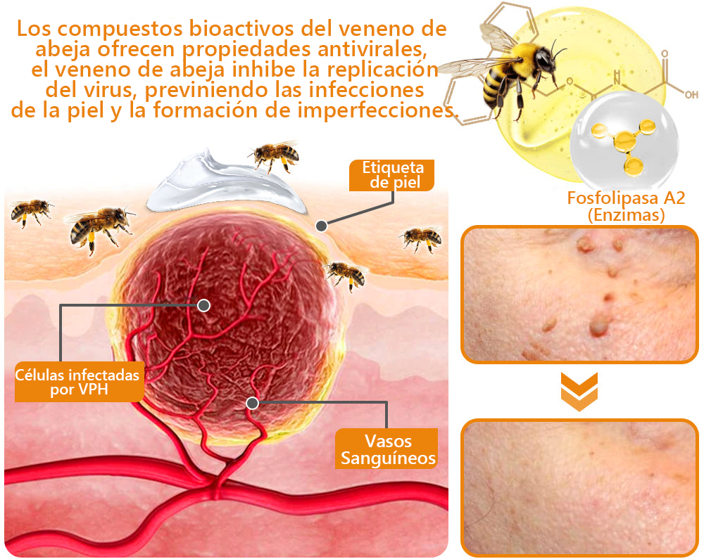 Lenaro™ Crema para el tratamiento de verrugas con veneno de abeja💎 (👨⚕️COFEPRIS RECOMMENDS)