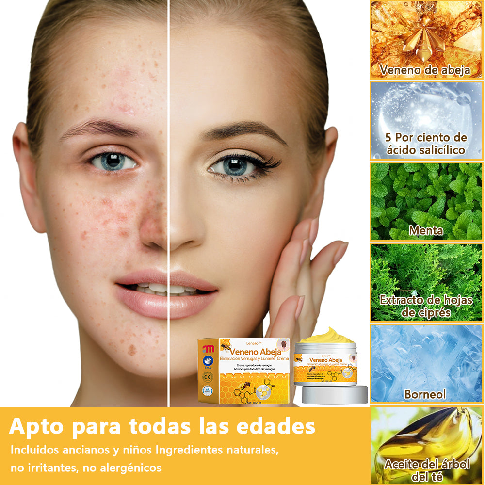 Lenaro™🏆🏆🏆 Veneno Abeja Eliminación Verrugas y Lunares Crema (🌞Último día de promoción 80% de descuento)