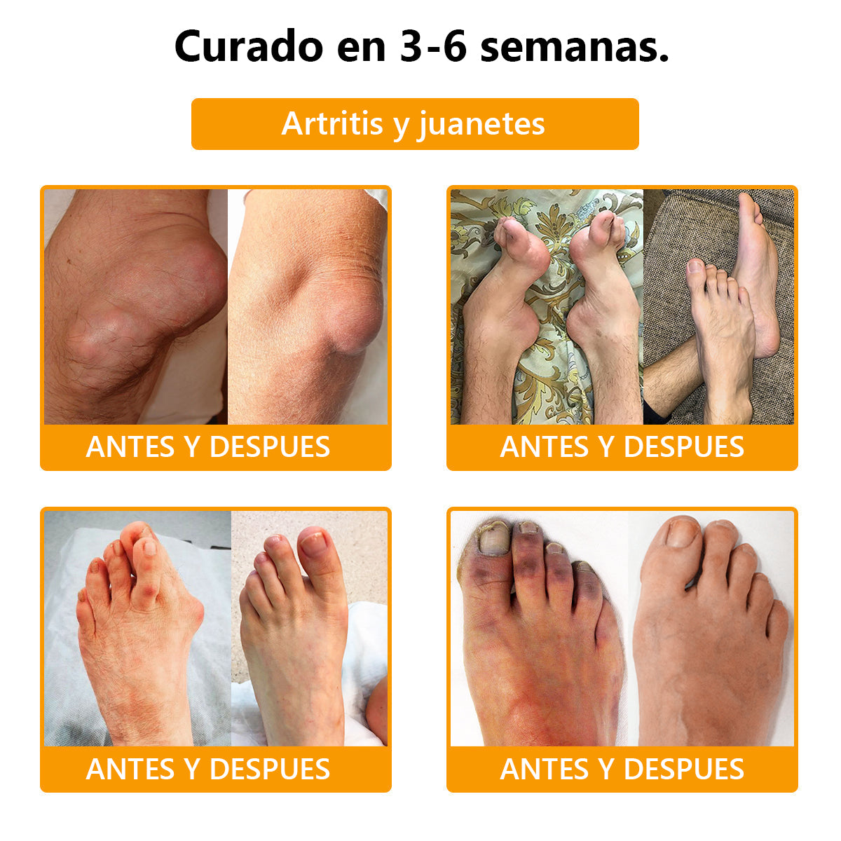 Lenaro™ Bee Venom & Turmeric Crema para el Alivio del Dolor en las Articulaciones y los Huesos (se especializa en el dolor de las articulaciones y la artritis y AAOS recomienda)