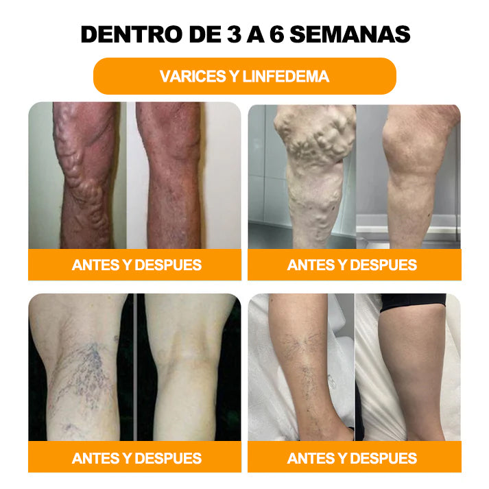 Último día con 70 % de descuento: Tnnedey® veneno de abeja y 30 perlas de baño de pies desintoxicantes a base de hierbas para esculpir el cuerpo - Recomendado por la Academia Linfática Mexicana (AML) 🌿