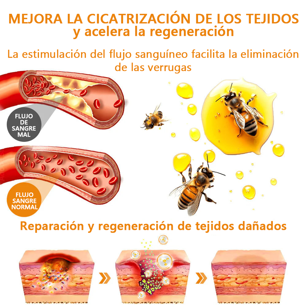 Lenaro™ Crema para el tratamiento de verrugas con veneno de abeja💎 (👨⚕️COFEPRIS RECOMMENDS)