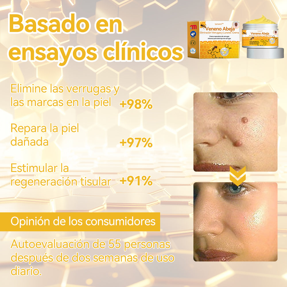 Lenaro™🏆🏆🏆 Veneno Abeja Eliminación Verrugas y Lunares Crema (🌞Último día de promoción 80% de descuento)