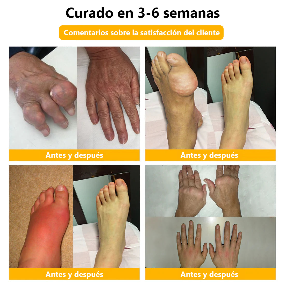 Lenaro™ Bee Venom & Turmeric Crema para el Alivio del Dolor en las Articulaciones y los Huesos (se especializa en el dolor de las articulaciones y la artritis y AAOS recomienda)