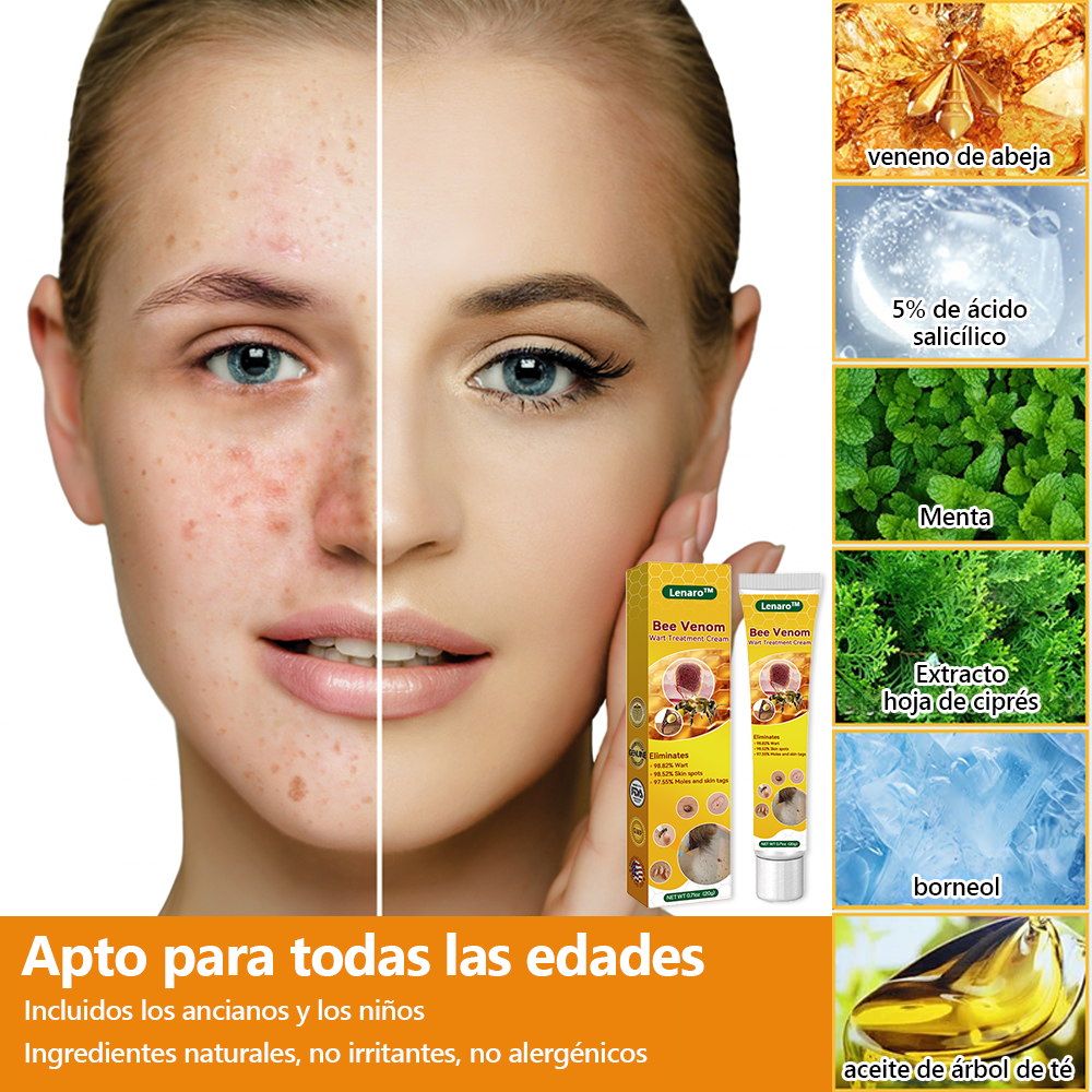 Lenaro™ Crema para el tratamiento de verrugas con veneno de abeja💎 (👨⚕️COFEPRIS RECOMMENDS)
