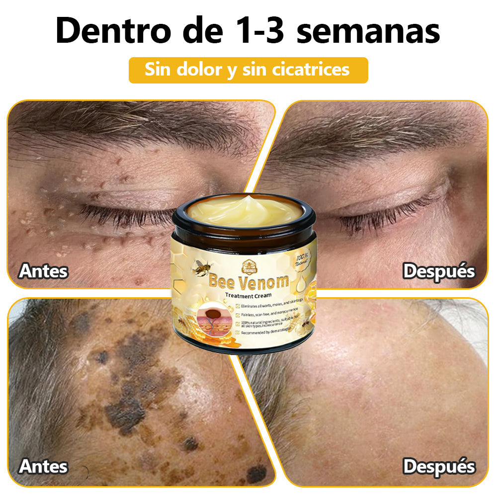 (Recomendado por UNAM) Crema de tratamiento para la piel con veneno de abeja Turonu™ 🛡️(🔥 promoción del último día con 80% de descuento🔥)🛡️