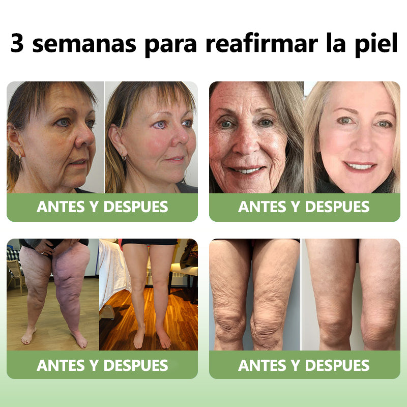 Último día de descuento: 70% de descuento💥LEFUN®Aceite rejuvenecedor reafirmante de la piel