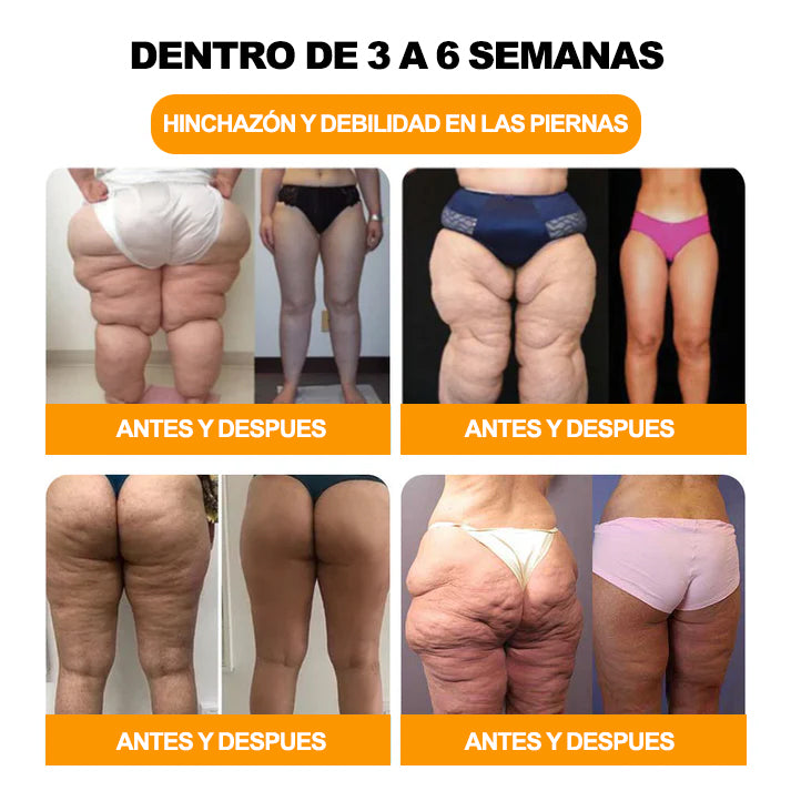 Último día con 70 % de descuento: Tnnedey® veneno de abeja y 30 perlas de baño de pies desintoxicantes a base de hierbas para esculpir el cuerpo - Recomendado por la Academia Linfática Mexicana (AML) 🌿