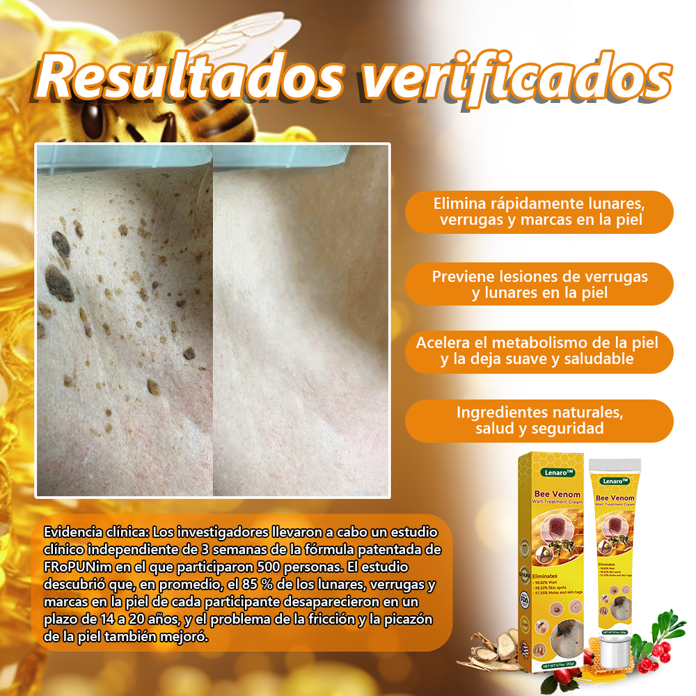 Lenaro™ Crema para el tratamiento de verrugas con veneno de abeja💎 (👨⚕️COFEPRIS RECOMMENDS)
