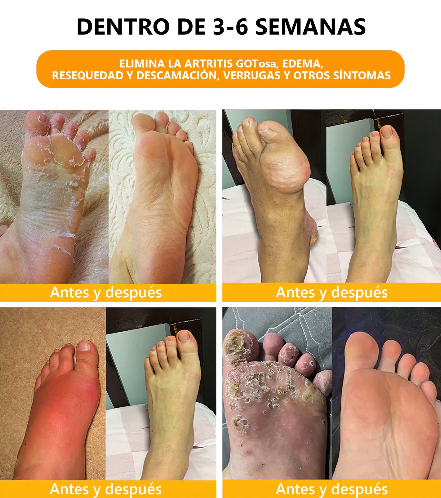 Último día con 70 % de descuento: Tnnedey® veneno de abeja y 30 perlas de baño de pies desintoxicantes a base de hierbas para esculpir el cuerpo - Recomendado por la Academia Linfática Mexicana (AML) 🌿