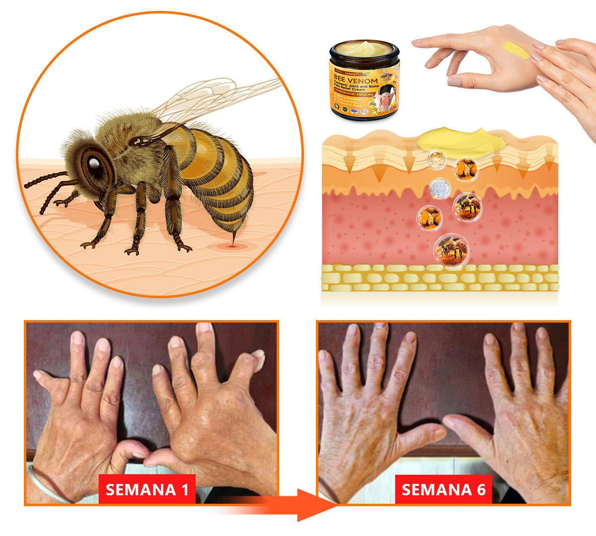 Lenaro™ Bee Venom & Turmeric Crema para el Alivio del Dolor en las Articulaciones y los Huesos (se especializa en el dolor de las articulaciones y la artritis y AAOS recomienda)