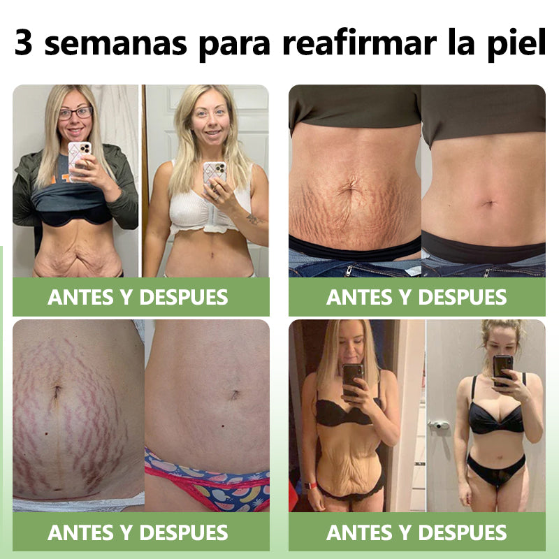 Último día de descuento: 70% de descuento💥LEFUN®Aceite rejuvenecedor reafirmante de la piel