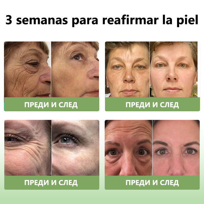 Último día de descuento: 70% de descuento💥LEFUN®Aceite rejuvenecedor reafirmante de la piel