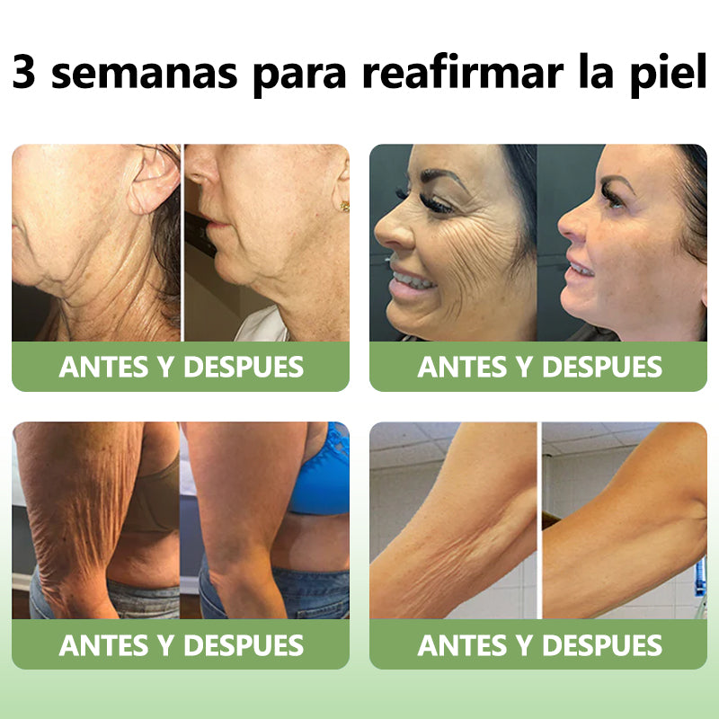 Último día de descuento: 70% de descuento💥LEFUN®Aceite rejuvenecedor reafirmante de la piel