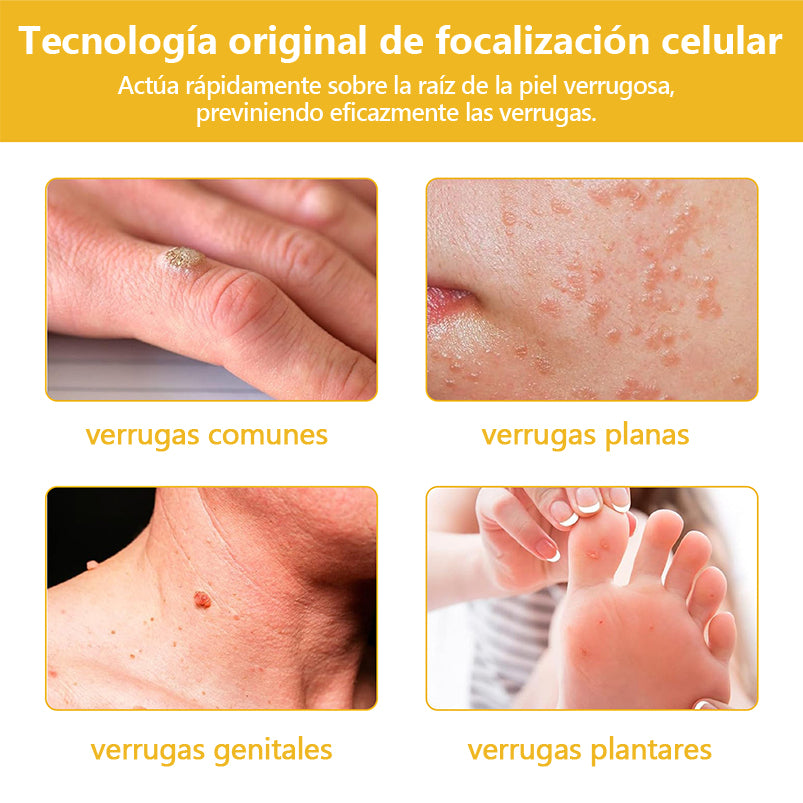 (Recomendado por UNAM) Crema de tratamiento para la piel con veneno de abeja Turonu™ 🛡️(🔥 promoción del último día con 80% de descuento🔥)🛡️