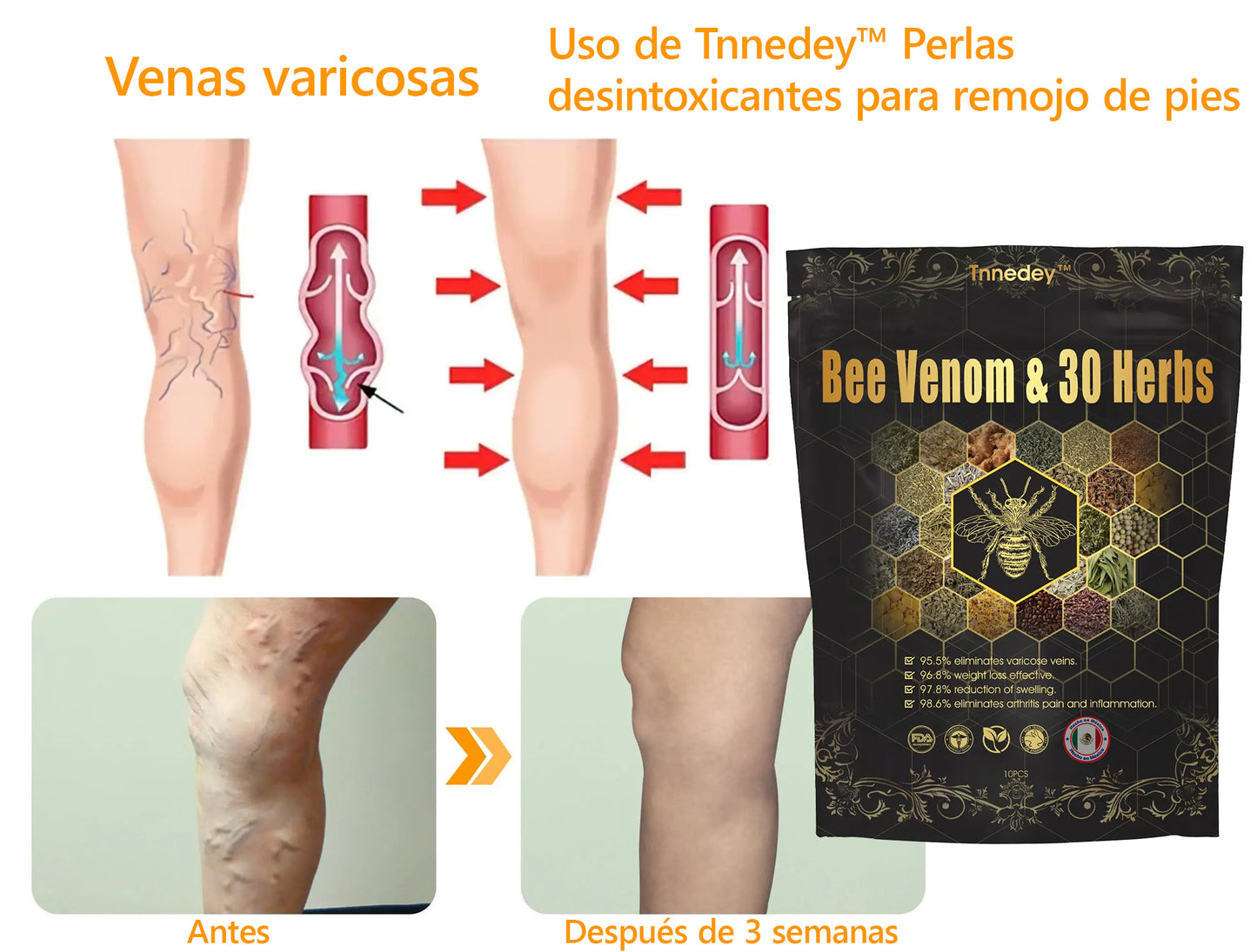 Último día con 70 % de descuento: Tnnedey® veneno de abeja y 30 perlas de baño de pies desintoxicantes a base de hierbas para esculpir el cuerpo - Recomendado por la Academia Linfática Mexicana (AML) 🌿