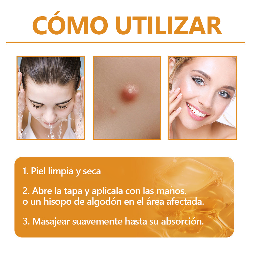 Lenaro™ Crema para el tratamiento de verrugas con veneno de abeja💎 (👨⚕️COFEPRIS RECOMMENDS)