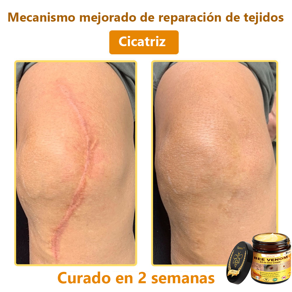 Turonu™ Bee Venom All-in-One Cream🎁Tiempo limitado 80% de descuento⏱️