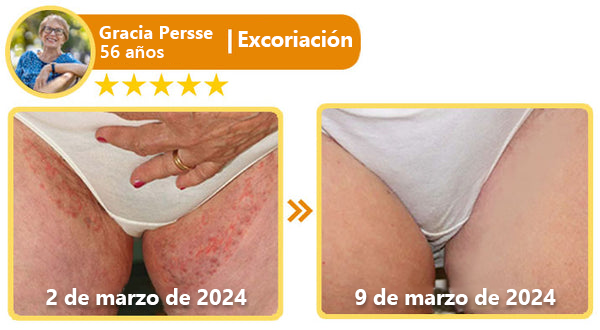 Turonu™ Bee Venom All-in-One Cream🎁Tiempo limitado 80% de descuento⏱️