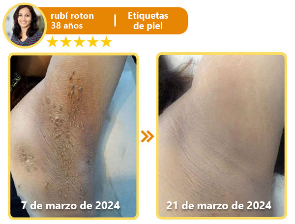 Turonu™ Bee Venom All-in-One Cream🎁Tiempo limitado 80% de descuento⏱️