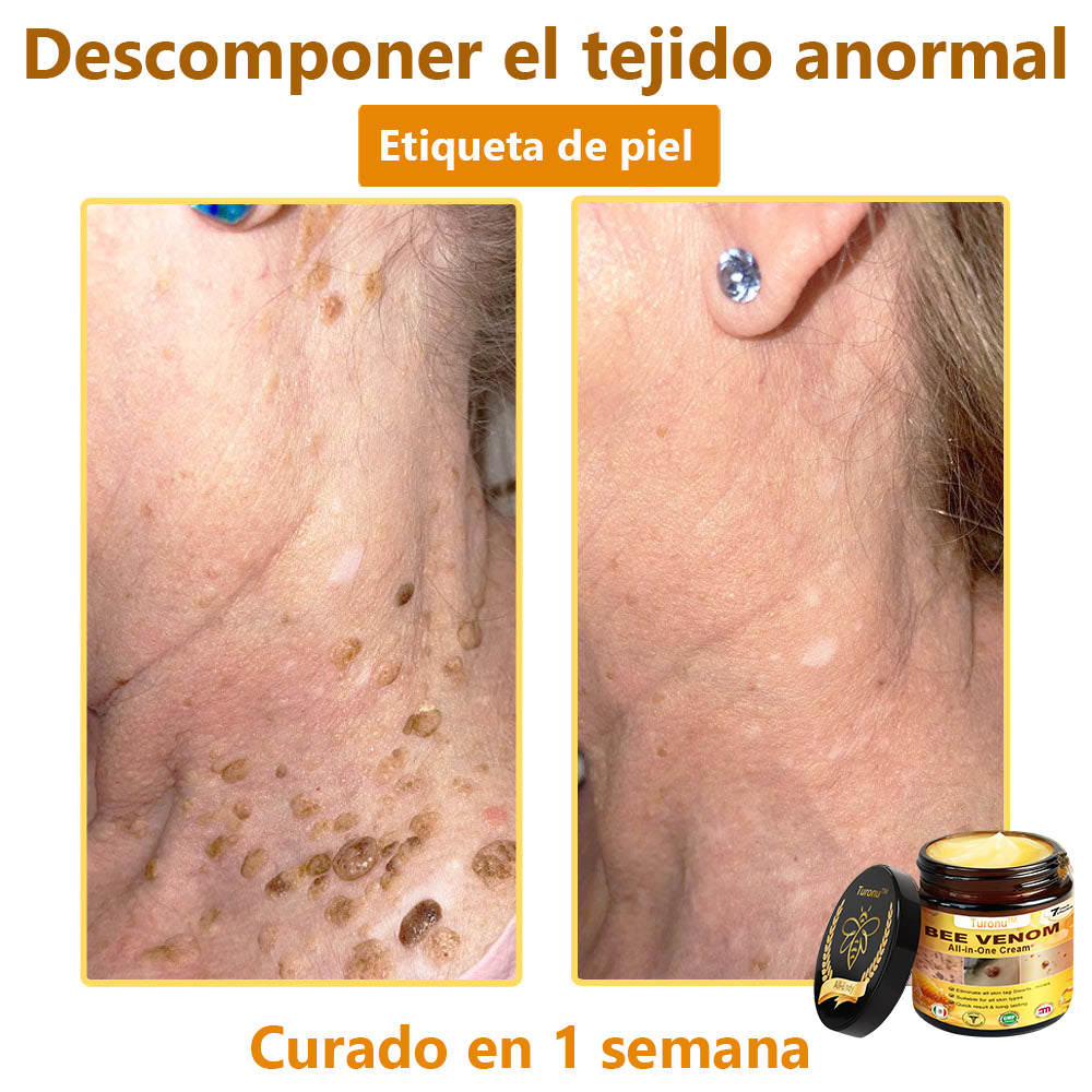 Turonu™ Bee Venom All-in-One Cream🎁Tiempo limitado 80% de descuento⏱️