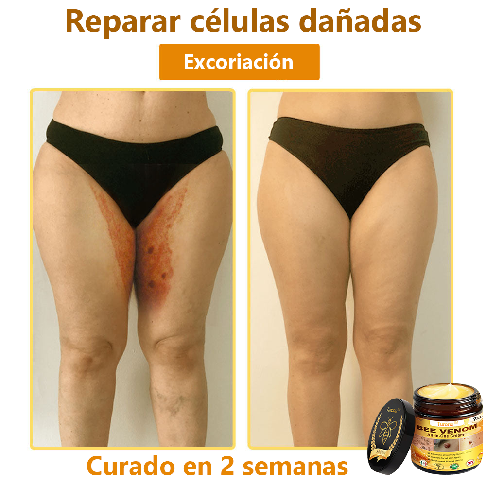 Turonu™ Bee Venom All-in-One Cream🎁Tiempo limitado 80% de descuento⏱️