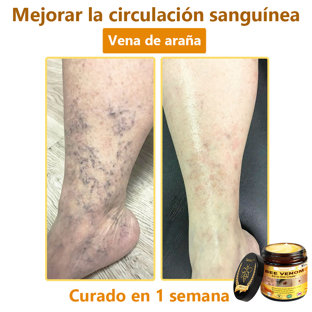 Turonu™ Bee Venom All-in-One Cream🎁Tiempo limitado 80% de descuento⏱️