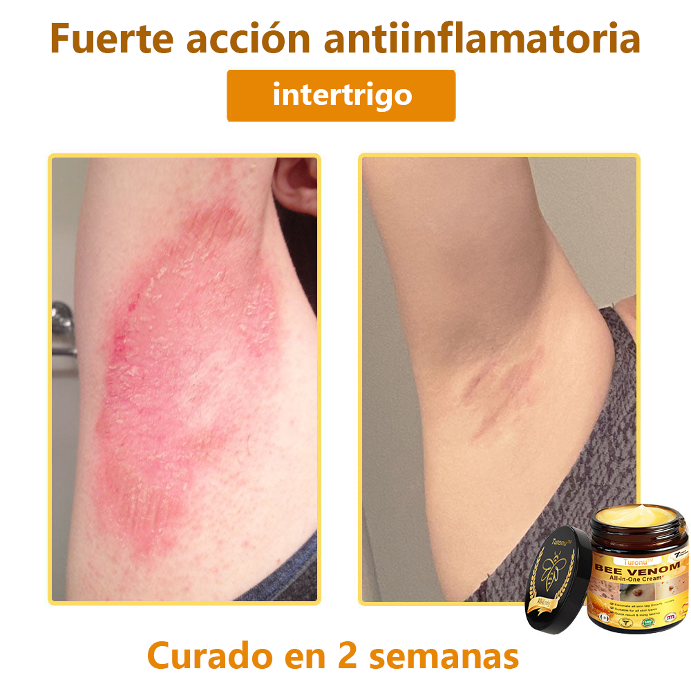 Turonu™ Bee Venom All-in-One Cream🎁Tiempo limitado 80% de descuento⏱️