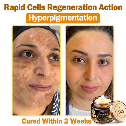 𝖠𝖾𝖾𝗁𝖿𝖾𝗇𝗀™ Crema de Cuidado de la Piel 7 Días Multi-efecto Todo-en-Uno 👩‍⚕️(Recomendada por la BAD)💎