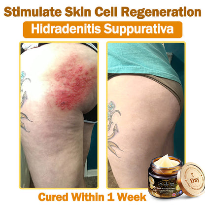 𝖠𝖾𝖾𝗁𝖿𝖾𝗇𝗀™ Crema de Cuidado de la Piel 7 Días Multi-efecto Todo-en-Uno 👩‍⚕️(Recomendada por la BAD)💎
