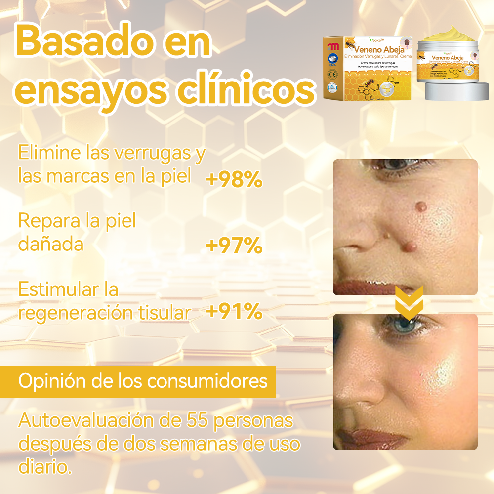 Vsóxa™ Veneno Abeja Eliminación Verrugas y Lunares Crema👑(Último día de promoción 80% de descuento)