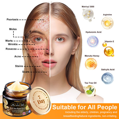 𝖠𝖾𝖾𝗁𝖿𝖾𝗇𝗀™ Crema de Cuidado de la Piel 7 Días Multi-efecto Todo-en-Uno 👩‍⚕️(Recomendada por la BAD)💎