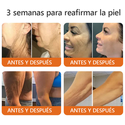 Hecho y enviado desde México ✨Lenaro™ Botox Bee Venom Firming Serum Stick 💥Último día 70% de descuento