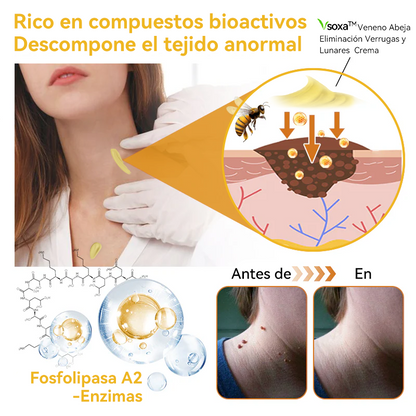 Vsóxa™ Veneno Abeja Eliminación Verrugas y Lunares Crema👑(Último día de promoción 80% de descuento)