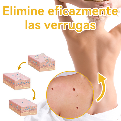 Vsóxa™ Veneno Abeja Eliminación Verrugas y Lunares Crema👑(Último día de promoción 80% de descuento)