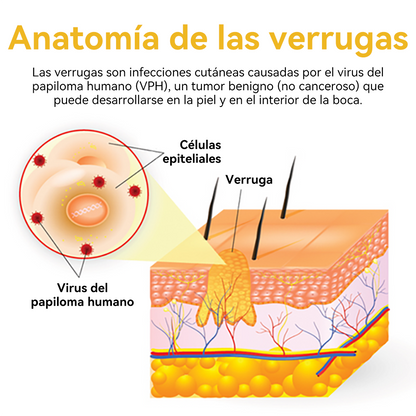 Vsóxa™ Veneno Abeja Eliminación Verrugas y Lunares Crema👑(Último día de promoción 80% de descuento)