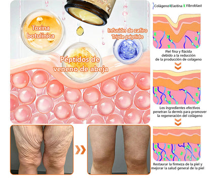 𝐓𝐢𝐞𝐧𝐝𝐚 𝐨𝐟𝐢𝐜𝐢𝐚𝐥👑 𝗟𝗲𝗻𝗮𝗿𝗼™ 𝗖𝗿𝗲𝗺𝗮 𝗺𝘂𝗹𝘁𝗶𝘂𝘀𝗼𝘀 𝗰𝗼𝗻 𝘃𝗲𝗻𝗲𝗻𝗼 𝗱𝗲 𝗮𝗯𝗲𝗷𝗮 - 𝗔𝗽𝗿𝗼𝗯𝗮𝗱𝗮 𝗽𝗼𝗿 𝗱𝗲𝗿𝗺𝗮𝘁ó𝗹𝗼𝗴𝗼𝘀 𝗺𝗲𝘅𝗶𝗰𝗮𝗻𝗼𝘀6👩‍⚕️