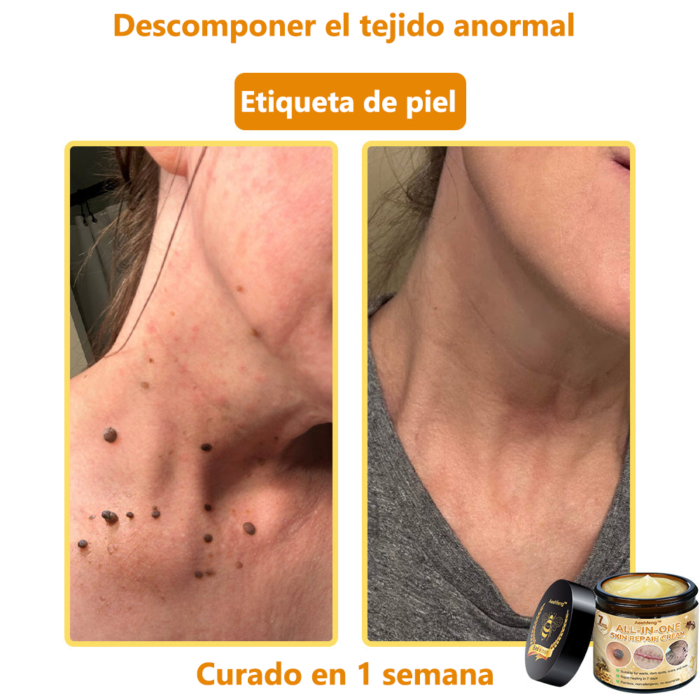 [Tienda Oficial de la Marca] ✨𝐀𝐞𝐞𝐡𝐟𝐞𝐧𝐠™ 𝐂𝐫è𝐚𝐦𝐚 𝐝𝐞 𝐕𝐢𝐧𝐨 𝐝𝐞 𝐇𝐨𝐧𝐝𝐚 𝐂𝐨𝐦𝐩𝐥𝐞𝐭𝐚 𝐝𝐞 𝐝𝐢𝐯𝐞𝐫𝐬𝐨𝐬 𝐧𝐮𝐞𝐬𝐭𝐫𝐨𝐬 𝐂𝐨𝐧𝐟𝐨𝐫𝐦𝐚𝐝𝐨 𝐩𝐨𝐫 𝐝𝐞𝐫𝐦𝐚𝐭𝐨𝐥𝐨𝐠𝐨𝐬 𝐝𝐞 𝐂𝐚𝐧𝐚𝐝𝐚 (👩‍⚕️𝐑𝐞𝐜𝐨𝐦𝐞𝐧𝐝𝐚𝐝𝐨 𝐩𝐨𝐫 A𝐀D).